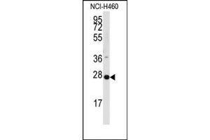 Image no. 1 for anti-Phosphatidic Acid Phosphatase Type 2C (PPAP2C) (C-Term) antibody (ABIN357966)
