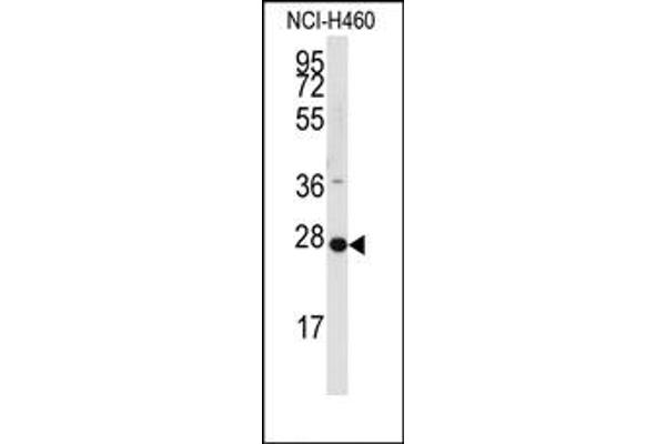 PPAP2C 抗体  (C-Term)