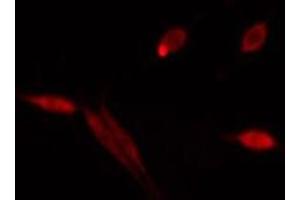 RUFY1 antibody  (Internal Region)