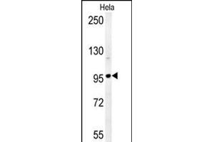 GIT1 antibody  (C-Term, Tyr554)