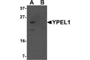 Image no. 2 for anti-Yippee-Like 1 (YPEL1) (N-Term) antibody (ABIN1450135)