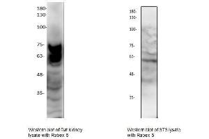 Image no. 1 for anti-RAB Guanine Nucleotide Exchange Factor (GEF) 1 (RABGEF1) (C-Term) antibody (ABIN1686089)