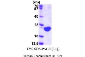 Image no. 1 for Dual Specificity Phosphatase 3 (DUSP3) (Active) protein (His tag) (ABIN1525910)