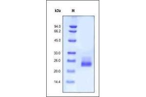 Image no. 2 for Interleukin 6 (IL6) (AA 30-212) (Active) protein (ABIN2181322)