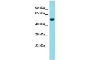 Image no. 1 for anti-Mex-3 Homolog A (MEX3A) (N-Term) antibody (ABIN2791265)