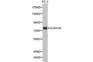 Western blot analysis of extracts of PC-3 cell lines, using SCNN1B antibody.