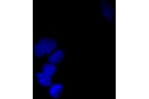 Image no. 4 for anti-Small Ubiquitin Related Modifier Protein 1 (SUMO1) (full length) antibody (ABIN2452138)