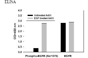 Image no. 3 for Epidermal Growth Factor Receptor (EGFR) ELISA Kit (ABIN625221)