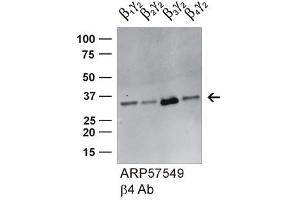 Image no. 1 for anti-Guanine Nucleotide Binding Protein (G Protein), beta Polypeptide 4 (GNB4) (Middle Region) antibody (ABIN2787271)