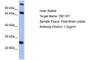 Image no. 1 for anti-TBC1 Domain Family, Member 7 (TBC1D7) (Middle Region) antibody (ABIN2786977)