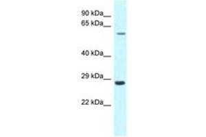 Image no. 1 for anti-Copine III (CPNE3) (C-Term) antibody (ABIN6747789)