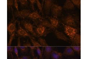 Immunofluorescence analysis of C6 cells using HIBADH Polyclonal Antibody at dilution of 1:100.