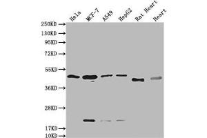 Western Blot Positive WB detected in: Hela whole cell lysate, MCF-7 whole cell lysate, A549 whole cell lysate, HepG2 whole cell lysate, Rat Heart tissue, Mouse Heart tissue All lanes: HTR3E antibody at 1:2000 Secondary Goat polyclonal to rabbit IgG at 1/50000 dilution Predicted band size: 52, 50, 53, 51, 54 kDa Observed band size: 50 kDa