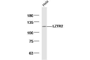 SEC16B Antikörper  (AA 351-450)