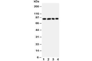Western blot testing of IL4R antibody and Lane 1:  A431;  2: SMMC-7721;  3: U87;  4: 293T cell lysate.
