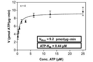 Image no. 1 for Discoidin Domain Receptor tyrosine Kinase 2 (DDR2) (AA 422-855) protein (His-GST) (ABIN5570020)