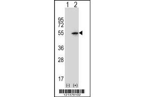 Image no. 2 for anti-Paired Box 6 (PAX6) (Center) antibody (ABIN2492206)