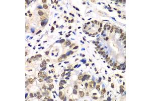 Image no. 1 for anti-Retinoblastoma Binding Protein 7 (RBBP7) antibody (ABIN6146745)