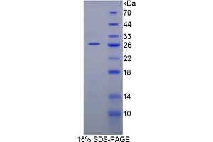 Image no. 1 for Interleukin 12 alpha (IL12A) (AA 23-215) protein (His tag) (ABIN6236553)