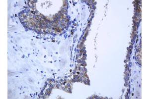 Image no. 2 for anti-Protocadherin 7 (PCDH7) antibody (ABIN1500048)