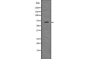 Image no. 3 for anti-PTEN Induced Putative Kinase 1 (PINK1) antibody (ABIN6264226)