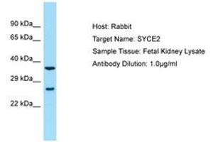 anti-Synaptonemal Complex Central Element Protein 2 (SYCE2) (AA 146-195) antibody
