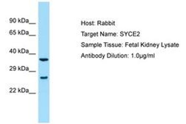 anti-Synaptonemal Complex Central Element Protein 2 (SYCE2) (AA 146-195) antibody