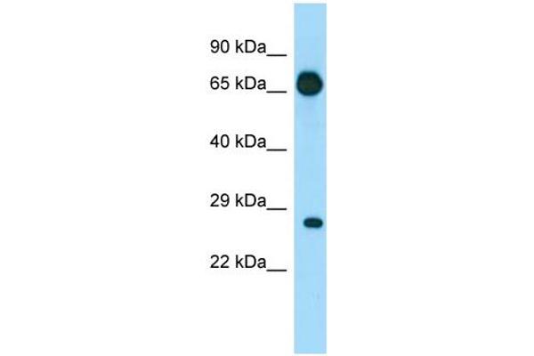 EIF4E1B 抗体  (N-Term)