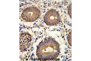 Image no. 1 for anti-Carcinoembryonic Antigen Gene Family (CEA) antibody (ABIN3002653)