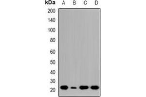 Image no. 1 for anti-Nucleoside-Triphosphatase, Cancer-Related (NTPCR) (C-Term) antibody (ABIN3222954)