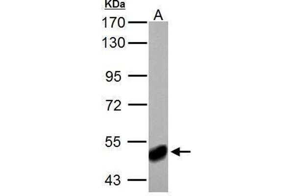 anti-4-Aminobutyrate Aminotransferase (ABAT) (Center) antibody