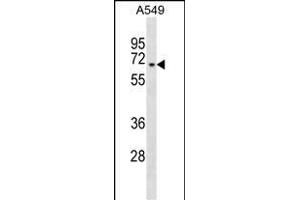 ZNF319 抗体  (C-Term)