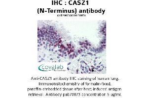 Image no. 1 for anti-Castor Zinc Finger 1 (CASZ1) (N-Term) antibody (ABIN1732691)