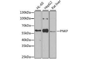 Image no. 1 for anti-Polynucleotide Kinase 3'-Phosphatase (PNKP) antibody (ABIN6145836)