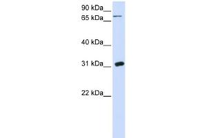 Image no. 1 for anti-Uridine Phosphorylase 1 (UPP1) (N-Term) antibody (ABIN2777156)