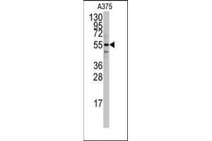 Image no. 2 for anti-Polymerase I and Transcript Release Factor (PTRF) (N-Term) antibody (ABIN359582)