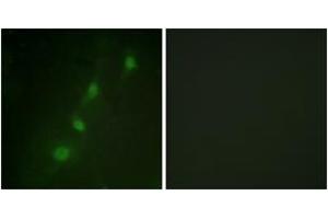 Image no. 3 for anti-serum/glucocorticoid Regulated Kinase 1 (SGK1) (AA 41-90) antibody (ABIN1532486)