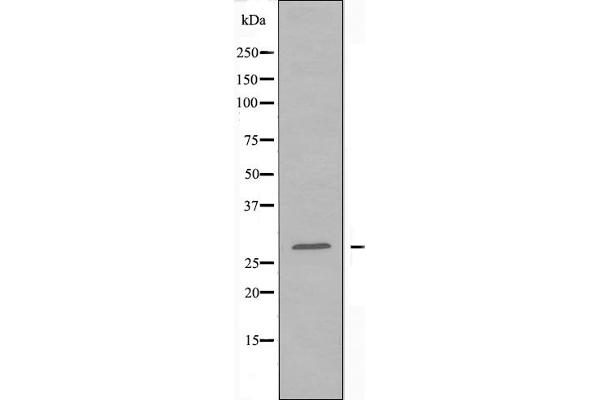 SIX Homeobox 6 antibody  (Internal Region)