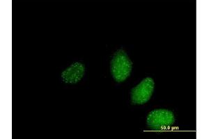 Image no. 2 for anti-SAP30-Like (SAP30L) (AA 1-183) antibody (ABIN5584771)
