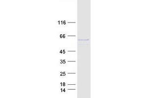 Image no. 1 for Prolyl 4-Hydroxylase, alpha Polypeptide I (P4HA1) (Transcript Variant 1) protein (Myc-DYKDDDDK Tag) (ABIN2728091)