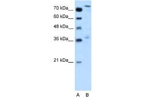 Image no. 1 for anti-Nuclear Factor (erythroid-Derived 2)-Like 3 (NFE2L3) (Middle Region) antibody (ABIN2778088)