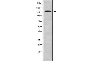 Western blot analysis of MEGF6 using Jurkat whole cell lysates