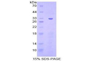 Image no. 1 for Checkpoint Kinase 1 (CHEK1) (AA 194-446) protein (His tag) (ABIN1879657)