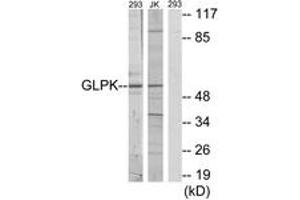 Image no. 1 for anti-Glycerol Kinase (GK) (AA 461-510) antibody (ABIN1533696)