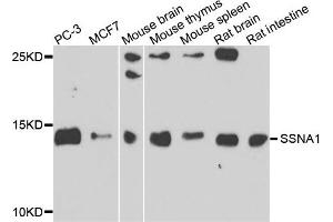 Image no. 2 for anti-Sjogren Syndrome Nuclear Autoantigen 1 (SSNA1) antibody (ABIN2737590)