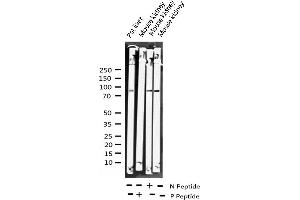 Image no. 3 for anti-Aryl Hydrocarbon Receptor (AHR) (pSer36) antibody (ABIN6256291)
