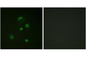 Immunofluorescence analysis of A549 cells, using CHOP (Phospho-Ser30) Antibody.