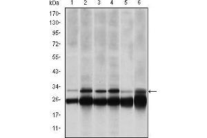 Image no. 5 for anti-Proteasome (Prosome, Macropain) Subunit, beta Type, 8 (Large Multifunctional Peptidase 7) (PSMB8) antibody (ABIN969371)