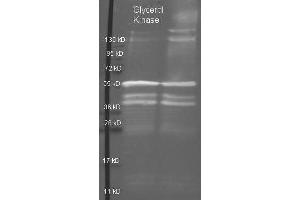 Image no. 1 for anti-Glycerol Kinase (GK) antibody (HRP) (ABIN5596716)
