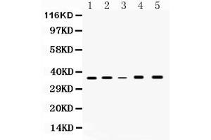 Image no. 3 for anti-Glyceraldehyde-3-Phosphate Dehydrogenase (GAPDH) (AA 136-335) antibody (ABIN5518757)